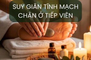 Suy giãn tĩnh mạch chân